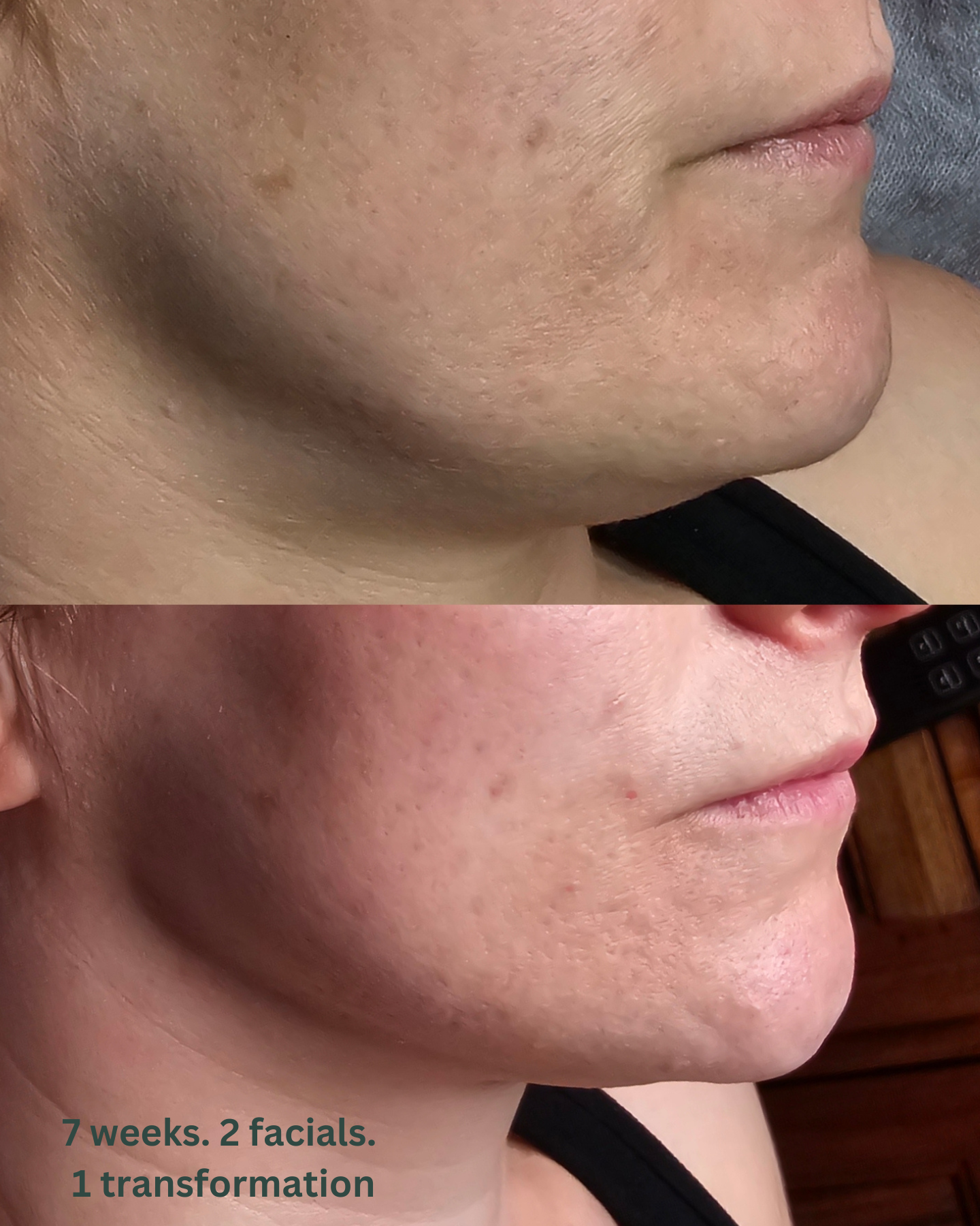The Signature Welcome Facial